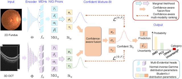 Figure 3 for Confidence-aware multi-modality learning for eye disease screening