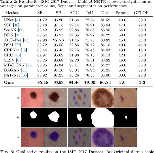 Figure 4 for MobileUNETR: A Lightweight End-To-End Hybrid Vision Transformer For Efficient Medical Image Segmentation