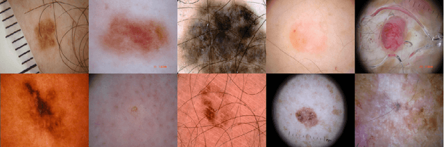 Figure 1 for MobileUNETR: A Lightweight End-To-End Hybrid Vision Transformer For Efficient Medical Image Segmentation