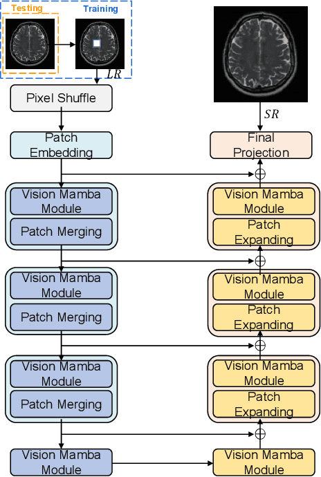 Figure 1 for Self-Prior Guided Mamba-UNet Networks for Medical Image Super-Resolution