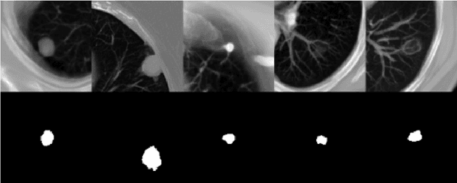 Figure 1 for Detection-Guided Deep Learning-Based Model with Spatial Regularization for Lung Nodule Segmentation