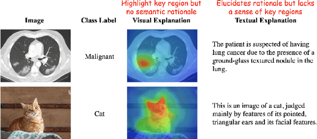 Figure 1 for MEGL: Multimodal Explanation-Guided Learning