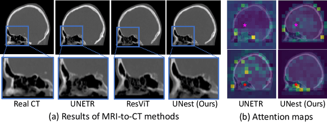 Figure 1 for Structural Attention: Rethinking Transformer for Unpaired Medical Image Synthesis