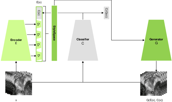 Figure 2 for ProjectedEx: Enhancing Generation in Explainable AI for Prostate Cancer