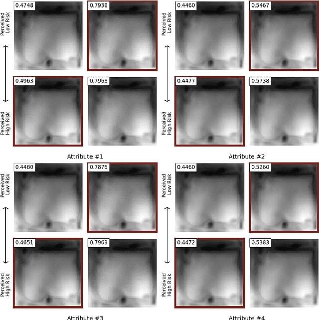 Figure 4 for ProjectedEx: Enhancing Generation in Explainable AI for Prostate Cancer