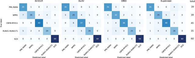 Figure 3 for Self-Supervised Multiple Instance Learning for Acute Myeloid Leukemia Classification