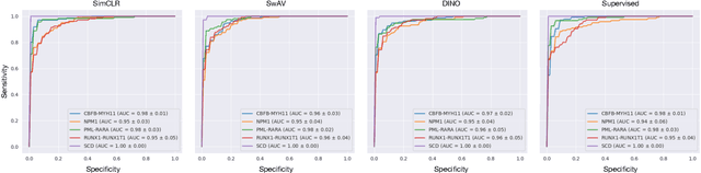 Figure 4 for Self-Supervised Multiple Instance Learning for Acute Myeloid Leukemia Classification