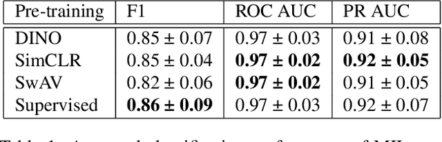 Figure 2 for Self-Supervised Multiple Instance Learning for Acute Myeloid Leukemia Classification