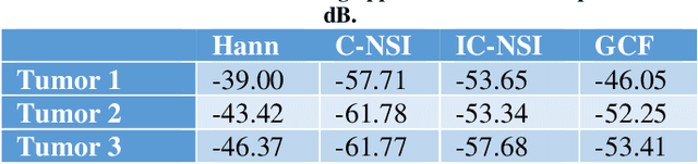 Figure 2 for Grating lobe reduction in plane wave imaging with angular compounding using subtraction of coherent signals