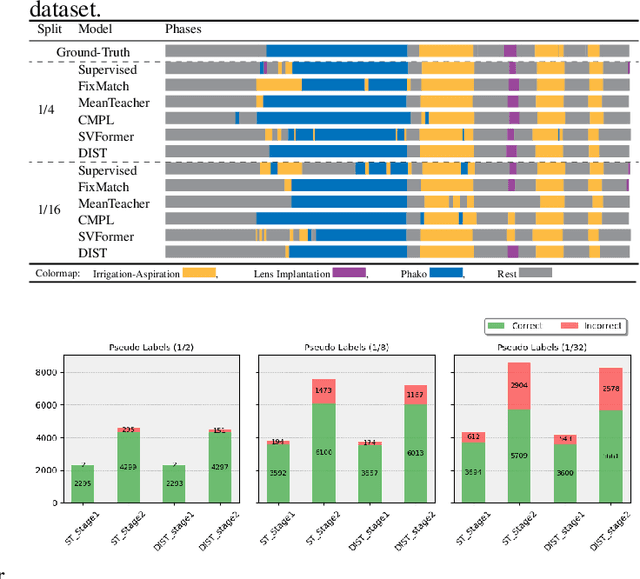 Figure 4 for Dual Invariance Self-training for Reliable Semi-supervised Surgical Phase Recognition