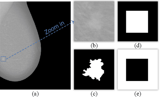 Figure 1 for Semi- and Weakly-Supervised Learning for Mammogram Mass Segmentation with Limited Annotations