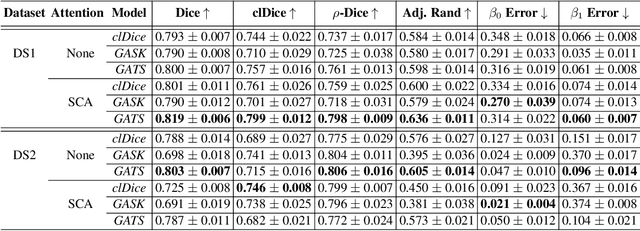Figure 2 for Improved Topological Preservation in 3D Axon Segmentation and Centerline Detection using Geometric Assessment-driven Topological Smoothing (GATS)