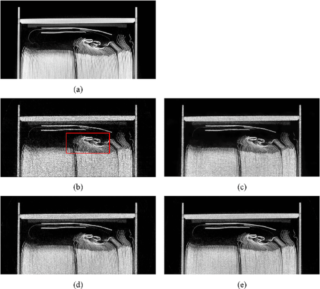 Figure 1 for A CT Image Denoising Method Based on Projection Domain Feature
