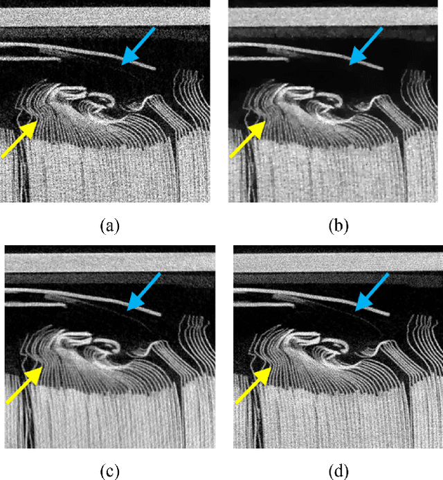 Figure 2 for A CT Image Denoising Method Based on Projection Domain Feature