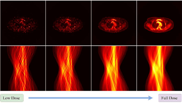 Figure 1 for RED: Residual Estimation Diffusion for Low-Dose PET Sinogram Reconstruction