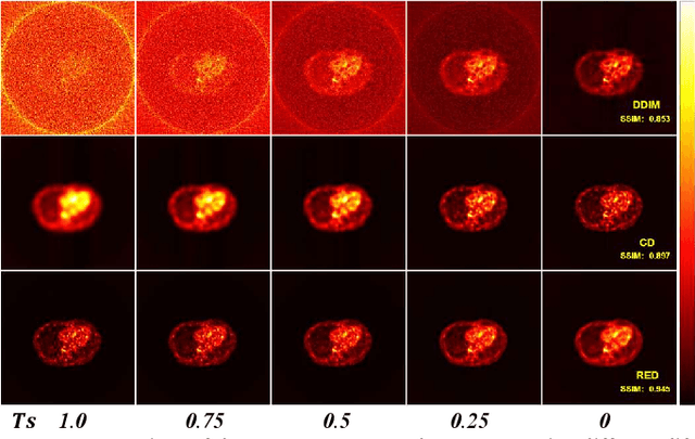 Figure 2 for RED: Residual Estimation Diffusion for Low-Dose PET Sinogram Reconstruction