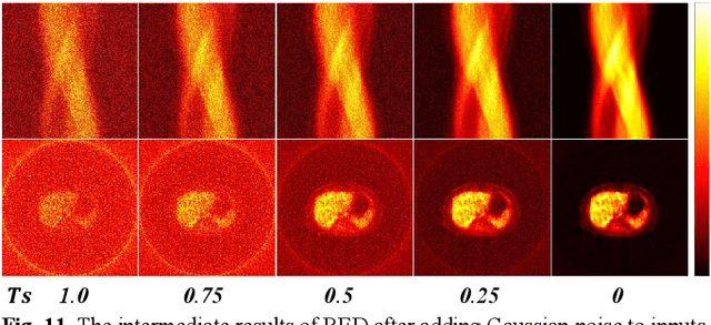 Figure 3 for RED: Residual Estimation Diffusion for Low-Dose PET Sinogram Reconstruction