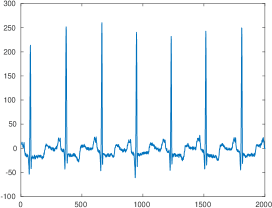 Figure 1 for Simultaneous Optimized Orthogonal Matching Pursuit with Application to ECG Compression