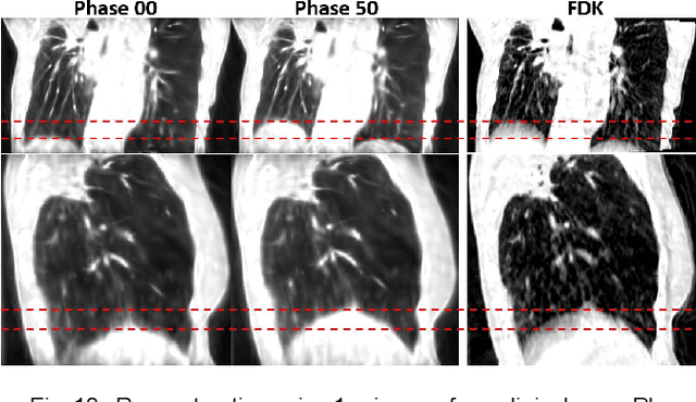 Figure 2 for Spatiotemporal Gaussian Optimization for 4D Cone Beam CT Reconstruction from Sparse Projections