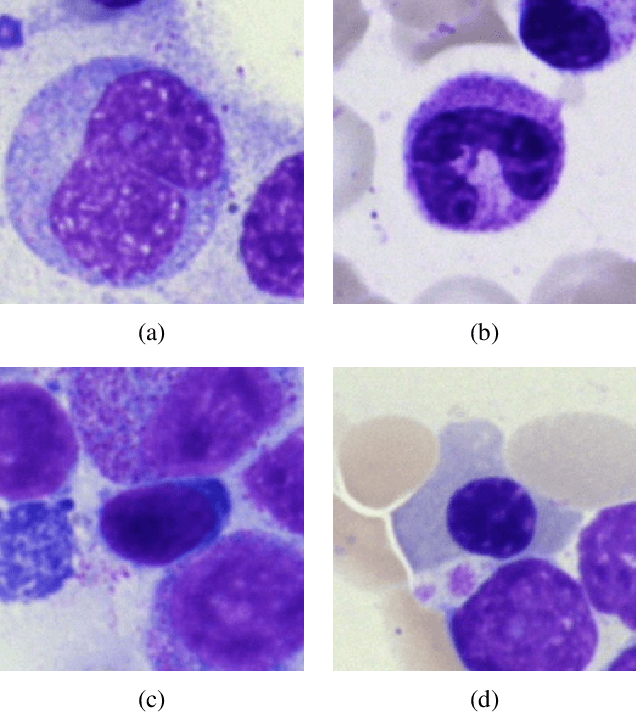 Figure 3 for Exploring Multi-Modality Dynamics: Insights and Challenges in Multimodal Fusion for Biomedical Tasks