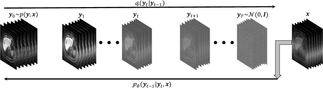 Figure 1 for Rapid Reconstruction of Extremely Accelerated Liver 4D MRI via Chained Iterative Refinement