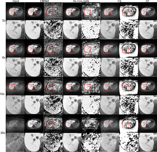 Figure 3 for Rapid Reconstruction of Extremely Accelerated Liver 4D MRI via Chained Iterative Refinement