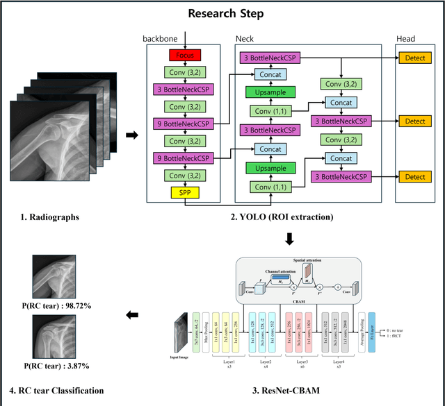 Figure 1 for Preoperative Rotator Cuff Tear Prediction from Shoulder Radiographs using a Convolutional Block Attention Module-Integrated Neural Network