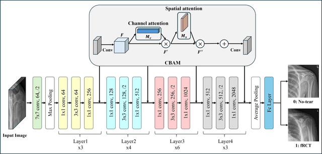 Figure 4 for Preoperative Rotator Cuff Tear Prediction from Shoulder Radiographs using a Convolutional Block Attention Module-Integrated Neural Network