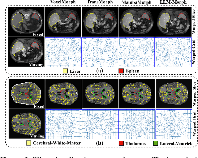 Figure 4 for Large Language Models for Multimodal Deformable Image Registration