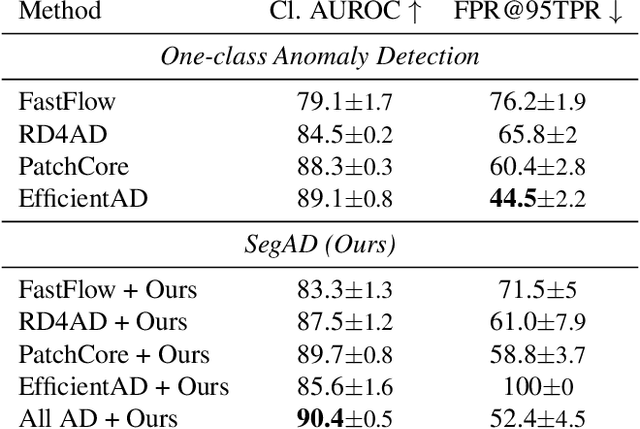 Figure 4 for Supervised Anomaly Detection for Complex Industrial Images