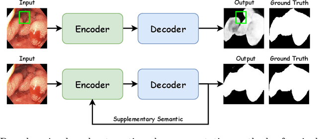 Figure 1 for Polyp-SES: Automatic Polyp Segmentation with Self-Enriched Semantic Model