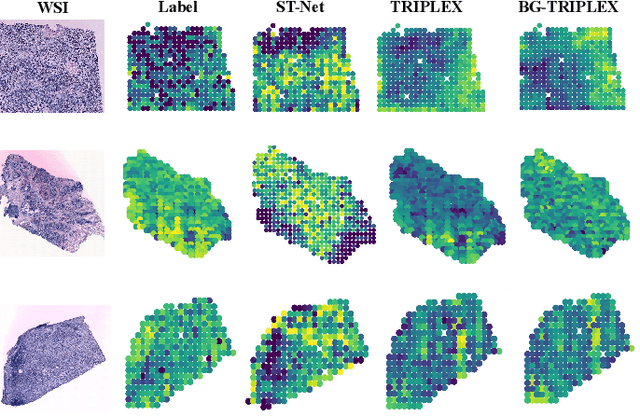 Figure 4 for Boundary-Guided Learning for Gene Expression Prediction in Spatial Transcriptomics