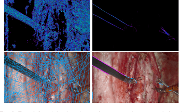 Figure 2 for Robust Surgical Tool Tracking with Pixel-based Probabilities for Projected Geometric Primitives