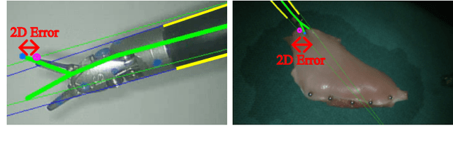 Figure 3 for Robust Surgical Tool Tracking with Pixel-based Probabilities for Projected Geometric Primitives