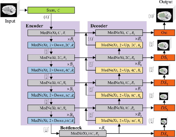 Figure 2 for 3D Graph Attention Networks for High Fidelity Pediatric Glioma Segmentation