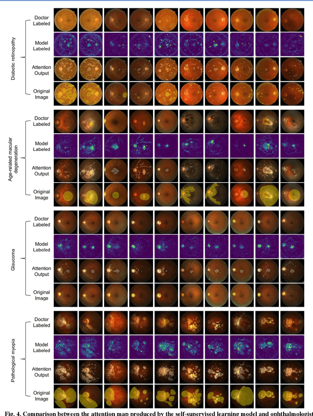 Figure 4 for Diagnosis of Multiple Fundus Disorders Amidst a Scarcity of Medical Experts Via Self-supervised Machine Learning