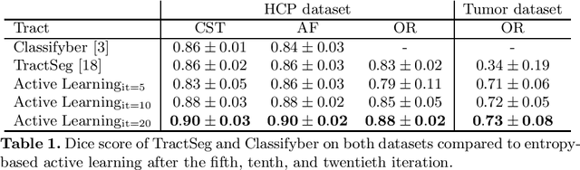 Figure 2 for atTRACTive: Semi-automatic white matter tract segmentation using active learning