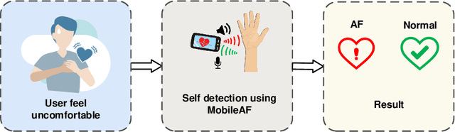 Figure 1 for Atrial Fibrillation Detection System via Acoustic Sensing for Mobile Phones