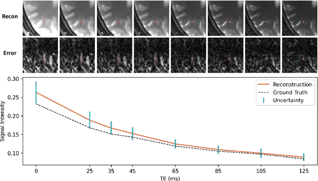 Figure 1 for Guiding Quantitative MRI Reconstruction with Phase-wise Uncertainty