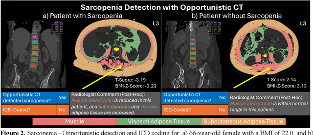 Figure 3 for Detecting Underdiagnosed Medical Conditions with Deep Learning-Based Opportunistic CT Imaging