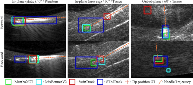 Figure 4 for MambaXCTrack: Mamba-based Tracker with SSM Cross-correlation and Motion Prompt for Ultrasound Needle Tracking