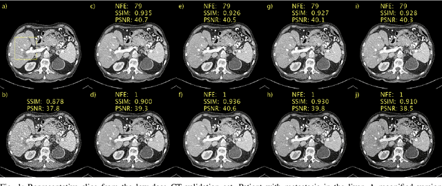 Figure 1 for Poisson flow consistency models for low-dose CT image denoising