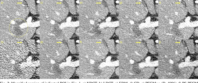 Figure 2 for Poisson flow consistency models for low-dose CT image denoising