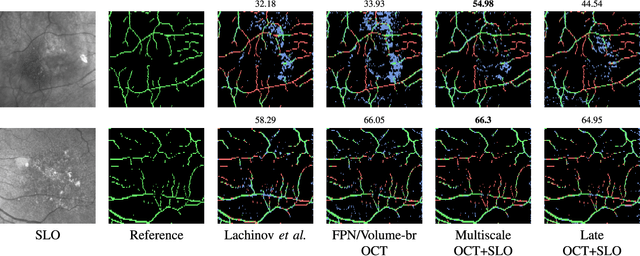 Figure 2 for Deep Multimodal Fusion of Data with Heterogeneous Dimensionality via Projective Networks