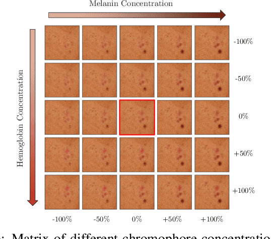 Figure 4 for Controllable and Gradual Facial Blemishes Retouching via Physics-Based Modelling