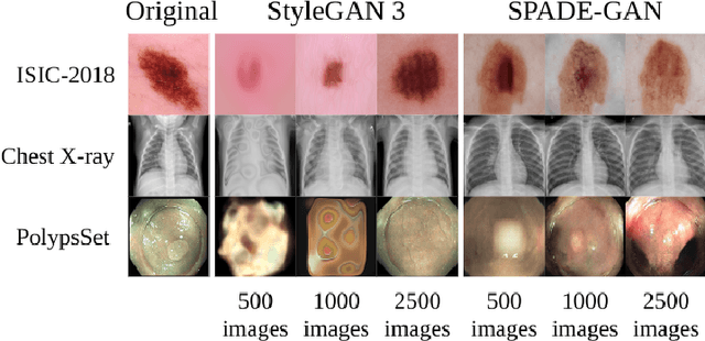 Figure 1 for Medical Imaging Complexity and its Effects on GAN Performance