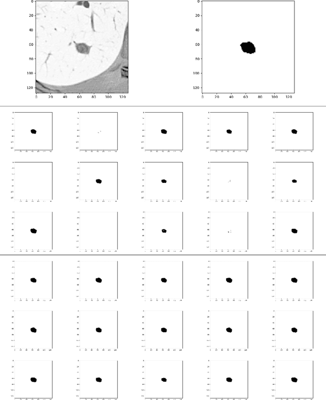 Figure 3 for Probabilistic U-Net with Kendall Shape Spaces for Geometry-Aware Segmentations of Images