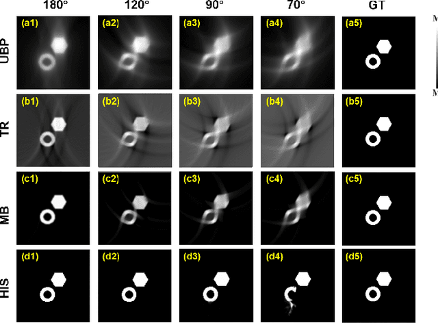 Figure 4 for Limited-View Photoacoustic Imaging Reconstruction Via High-quality Self-supervised Neural Representation