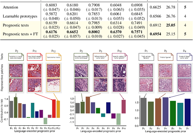 Figure 3 for Interpretable Vision-Language Survival Analysis with Ordinal Inductive Bias for Computational Pathology