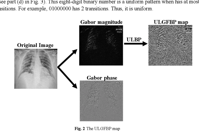 Figure 4 for COVID-19 Diagnosis: ULGFBP-ResNet51 approach on the CT and the Chest X-ray Images Classification